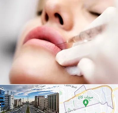 کلینیک تزریق ژل لب در سعادت آباد تهران