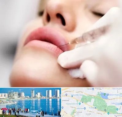 کلینیک تزریق ژل لب در چیتگر