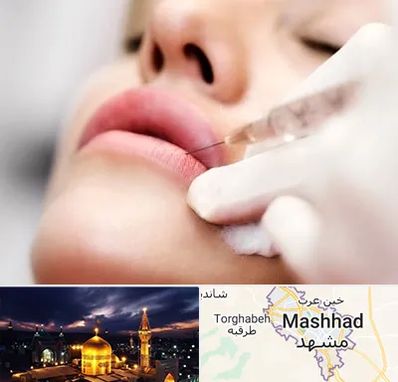 کلینیک تزریق ژل لب در مشهد