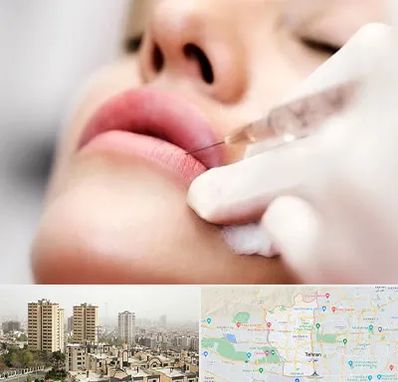 کلینیک تزریق ژل لب در منطقه 5 تهران