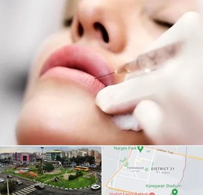 کلینیک تزریق ژل لب در تهرانسر