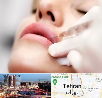 کلینیک تزریق ژل لب در صادقیه تهران