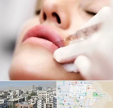 کلینیک تزریق ژل لب در منطقه 14 تهران