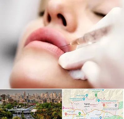 کلینیک تزریق ژل لب در منطقه 1 تهران