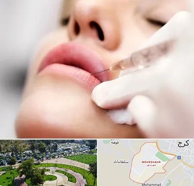 کلینیک تزریق ژل لب در مهرشهر کرج