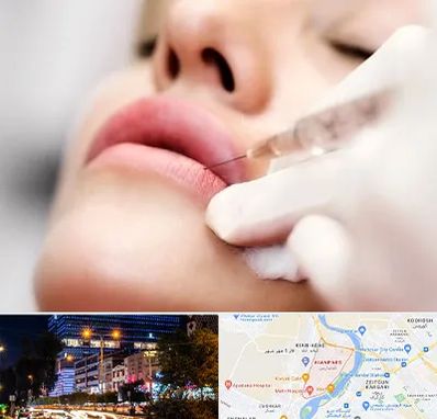 کلینیک تزریق ژل لب در کیانپارس اهواز