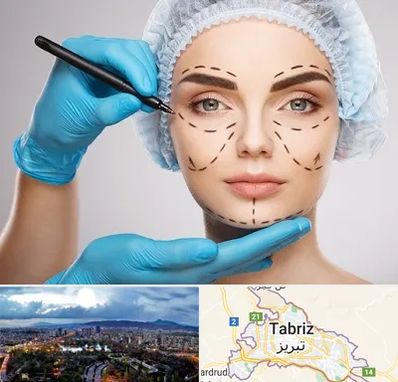 جراح فک و صورت در تبریز