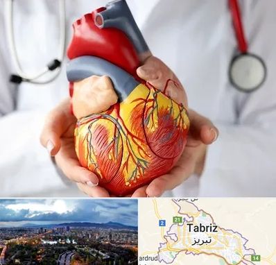 دکتر متخصص قلب و عروق در تبریز
