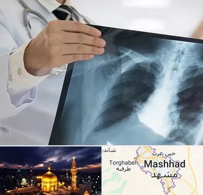فوق تخصص ریه در مشهد
