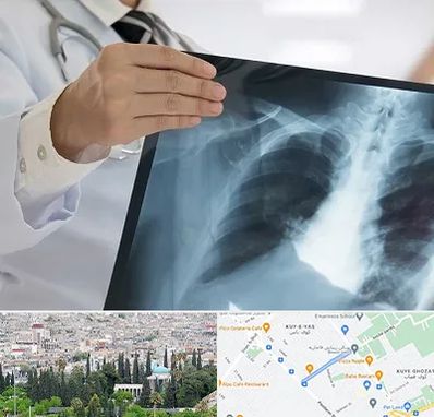 فوق تخصص ریه در محلاتی شیراز