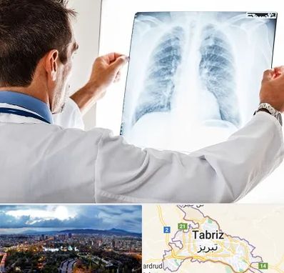 دکتر متخصص ریه در تبریز