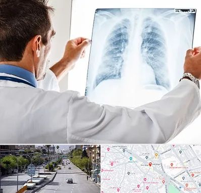 دکتر متخصص ریه در خیابان زند شیراز