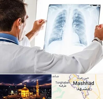 دکتر متخصص ریه در مشهد