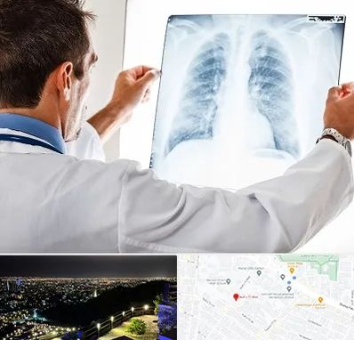 دکتر متخصص ریه در هفت تیر مشهد