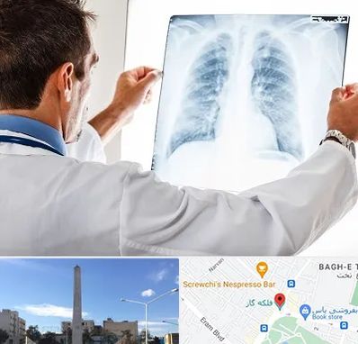 دکتر متخصص ریه در فلکه گاز شیراز