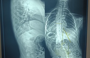 آکادمی حرکات اصلاحی نیرا 