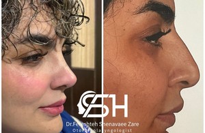 عمل بینی بندرعباس دکتر شنوائی زارع