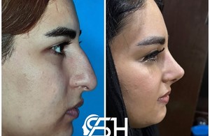 عمل بینی بندرعباس دکتر شنوائی زارع