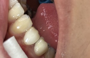 مطب دندانپزشکی دکتر کوثر قلی زاده