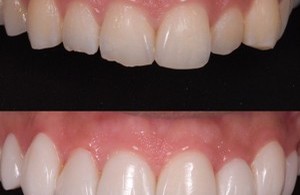 مطب دندانپزشکی دکتر کوثر قلی زاده