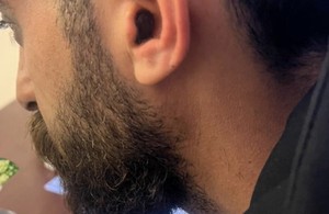 کلینیک شنوایی و سمعک حانا