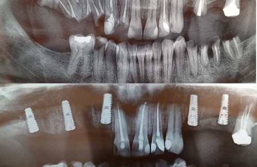 دندانپزشکی دندونه