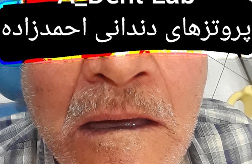 دندانسازی احمدزاده