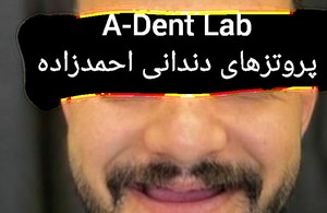 دندانسازی احمدزاده