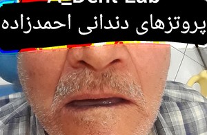 دندانسازی احمدزاده