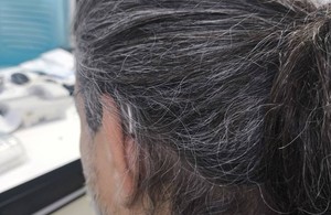 کلینیک شنوایی و سمعک اکو اکباتان